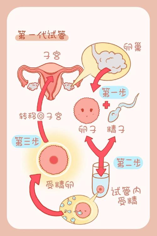 供卵试管过程_供卵试管:孕育生命的奇迹