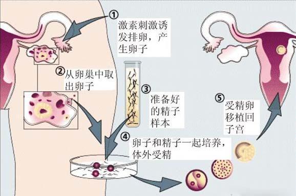 供卵生的孩子是自己的吗(供卵生的孩子是自己的吗?真相揭秘)